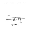 ENDOVASCULAR CONDUIT DEVICE WITH LOW PROFILE OCCLUSION MEMBERS diagram and image