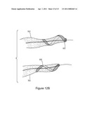 ENDOVASCULAR CONDUIT DEVICE WITH LOW PROFILE OCCLUSION MEMBERS diagram and image