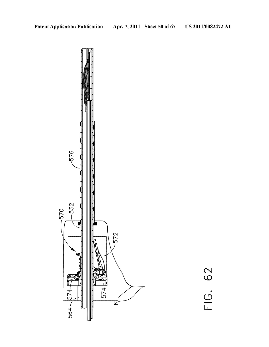 Method For Deploying Fasteners For Use In a Gastric Volume Reduction Procedure - diagram, schematic, and image 51