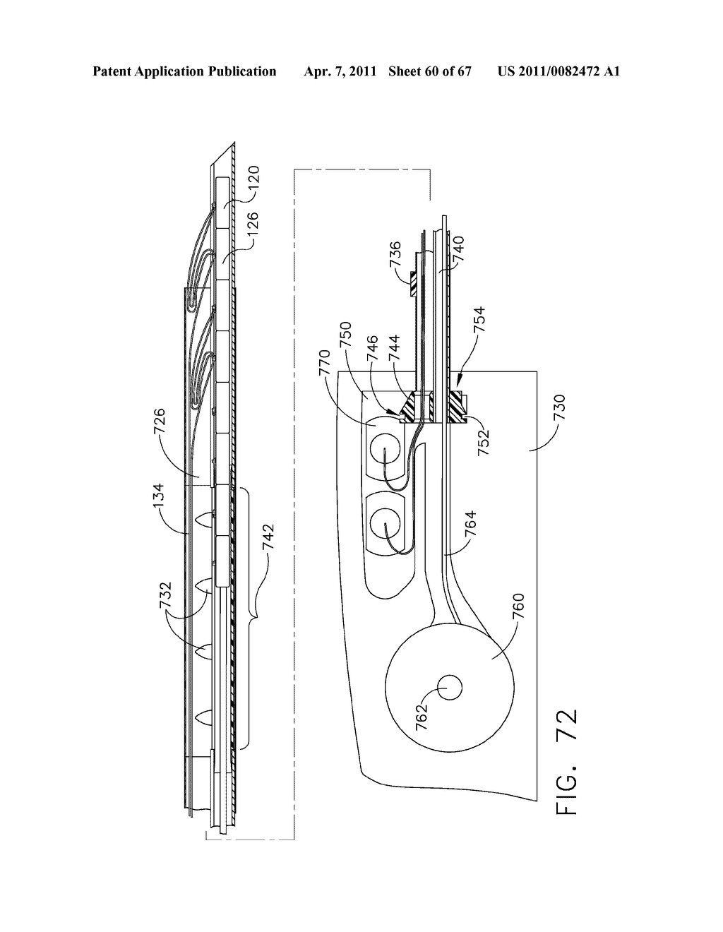 Method For Deploying Fasteners For Use In a Gastric Volume Reduction Procedure - diagram, schematic, and image 61