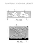 MEDICAL DEVICE diagram and image