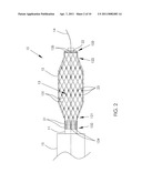 Cutting balloon assembly and method of manufacturing thereof diagram and image