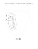 SENSOR INSERTER ASSEMBLY HAVING ROTATABLE TRIGGER diagram and image