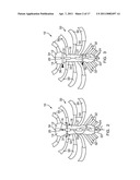 METHODS AND DEVICES FOR STERNAL CLOSURE diagram and image