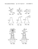 METHODS AND DEVICES FOR STERNAL CLOSURE diagram and image