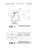 DECIDING ON PATIENT ELECTRIC SHOCK THERAPY diagram and image