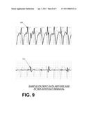 DECIDING ON PATIENT ELECTRIC SHOCK THERAPY diagram and image