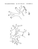 HYPERTENSION THERAPY BASED ON ACTIVITY AND CIRCADIAN RHYTHM diagram and image