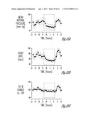 HYPERTENSION THERAPY BASED ON ACTIVITY AND CIRCADIAN RHYTHM diagram and image