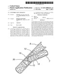 Extendible Stent Apparatus diagram and image