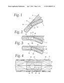 Extendible Stent Apparatus diagram and image