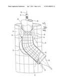 Extendible Stent Apparatus diagram and image