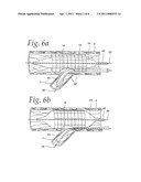 Extendible Stent Apparatus diagram and image