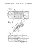 Extendible Stent Apparatus diagram and image