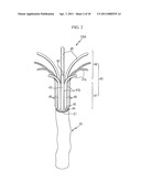 BALLOON TYPE STENT SYSTEM FOR TREATMENT OF OBESITY diagram and image