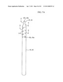 BALLOON TYPE STENT SYSTEM FOR TREATMENT OF OBESITY diagram and image