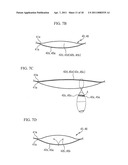 BALLOON TYPE STENT SYSTEM FOR TREATMENT OF OBESITY diagram and image