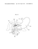 BALLOON TYPE STENT SYSTEM FOR TREATMENT OF OBESITY diagram and image