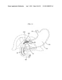 BALLOON TYPE STENT SYSTEM FOR TREATMENT OF OBESITY diagram and image