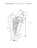 PROSTHETIC BODY FOR AN UPPER LEG PROSTHETIC diagram and image