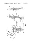 PROSTHETIC BODY FOR AN UPPER LEG PROSTHETIC diagram and image