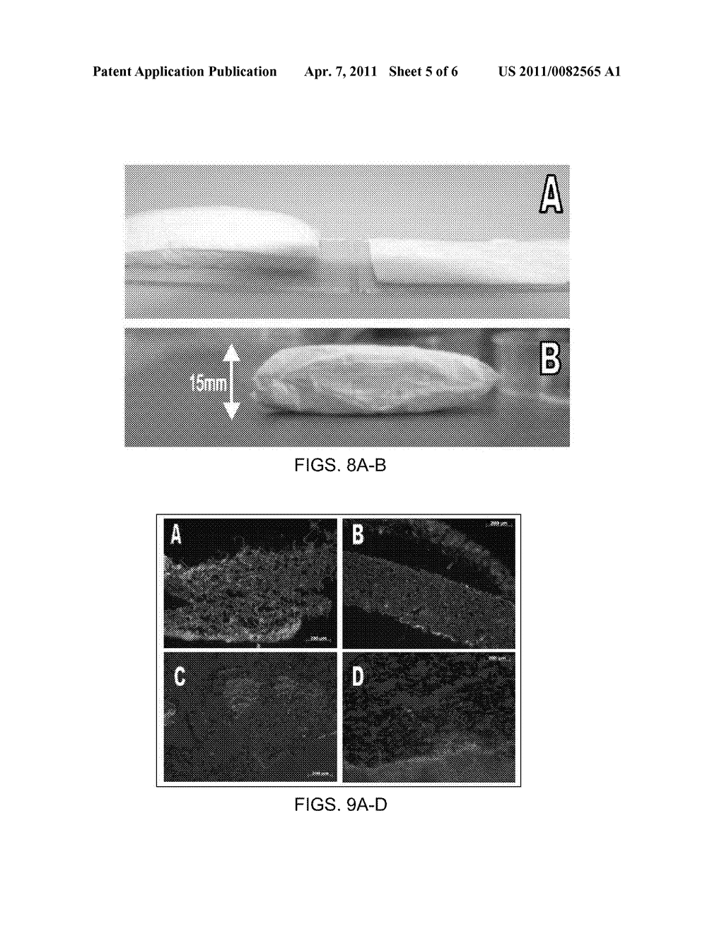 NONWOVEN STRUCTURE AND METHOD OF FABRICATING THE SAME - diagram, schematic, and image 06