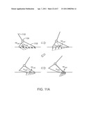 IMPLEMENTING A STAND-UP SEQUENCE USING A LOWER-EXTREMITY PROSTHESIS OR ORTHOSIS diagram and image