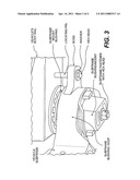 SUBFRAME LOCATING DEVICE diagram and image