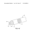 TANGLE RESISTANT FLEXIBLE ELONGATED DEVICE diagram and image