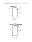 CAPSULE FOR TWO-COMPONENT MATERIALS diagram and image