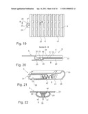 VEHICLE WITH TRANSPARENT ROOF AREA diagram and image