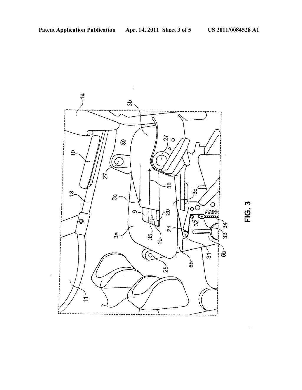 Delordosation device - diagram, schematic, and image 04