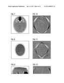 Reconstruction of 3D image datasets from x-ray and cone-beam data diagram and image