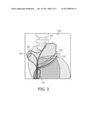 DEVICE AND METHOD FOR LOCALIZING AN OBJECT OF INTEREST IN A SUBJECT diagram and image