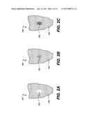 METHOD FOR EXTRACTING A CARIOUS LESION AREA diagram and image