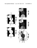 METHOD FOR EXTRACTING A CARIOUS LESION AREA diagram and image