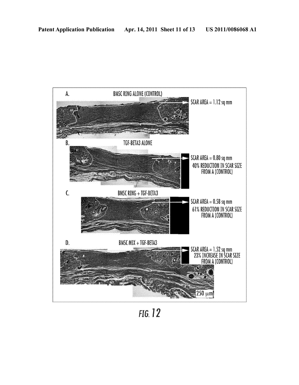 Compositions and Methods for Tissue Engineering, Tissue Regeneration and Wound Healing - diagram, schematic, and image 12