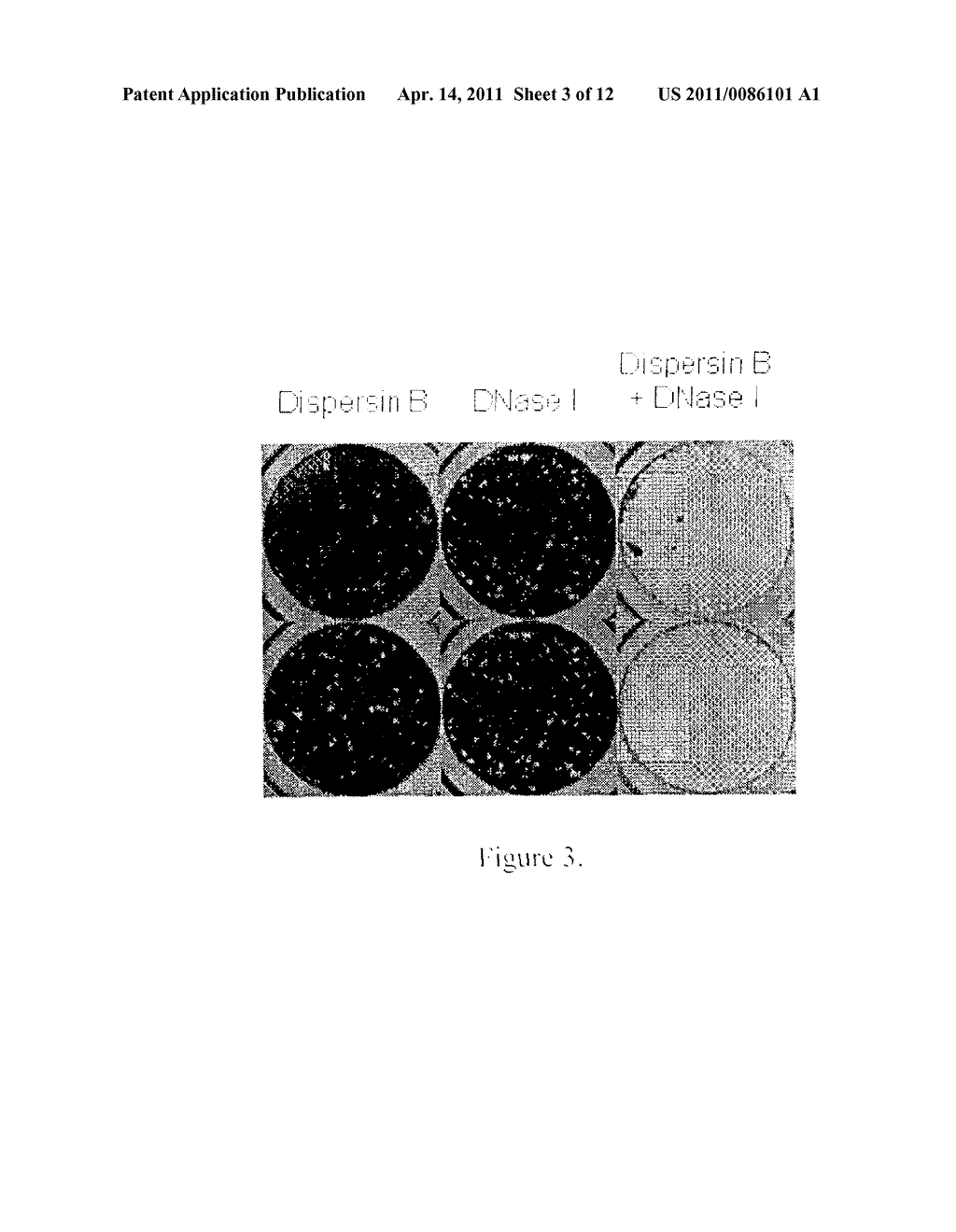 Dispersinb, 5-Fluorouracil, Deoxyribonuclease I and Proteinase K-Based Antibiofilm Compositions and Uses Thereof - diagram, schematic, and image 04