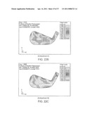 SET OF GOLF CLUBS diagram and image