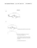 Protein Detection Via Nanoreporters diagram and image