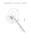 METHOD AND DEVICE FOR UTERINE FIBROID TREATMENT diagram and image