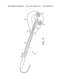 METHOD AND DEVICE FOR UTERINE FIBROID TREATMENT diagram and image