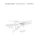 METHODS AND APPARATUS FOR DETERMINING FALLOPIAN TUBE OCCLUSION diagram and image