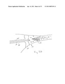 METHODS AND APPARATUS FOR DETERMINING FALLOPIAN TUBE OCCLUSION diagram and image