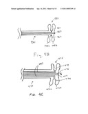 METHODS AND APPARATUS FOR DETERMINING FALLOPIAN TUBE OCCLUSION diagram and image