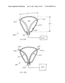 METHODS AND APPARATUS FOR DETERMINING FALLOPIAN TUBE OCCLUSION diagram and image