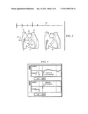 Methods and apparatus for locating the fossa ovalis and performing transseptal puncture diagram and image