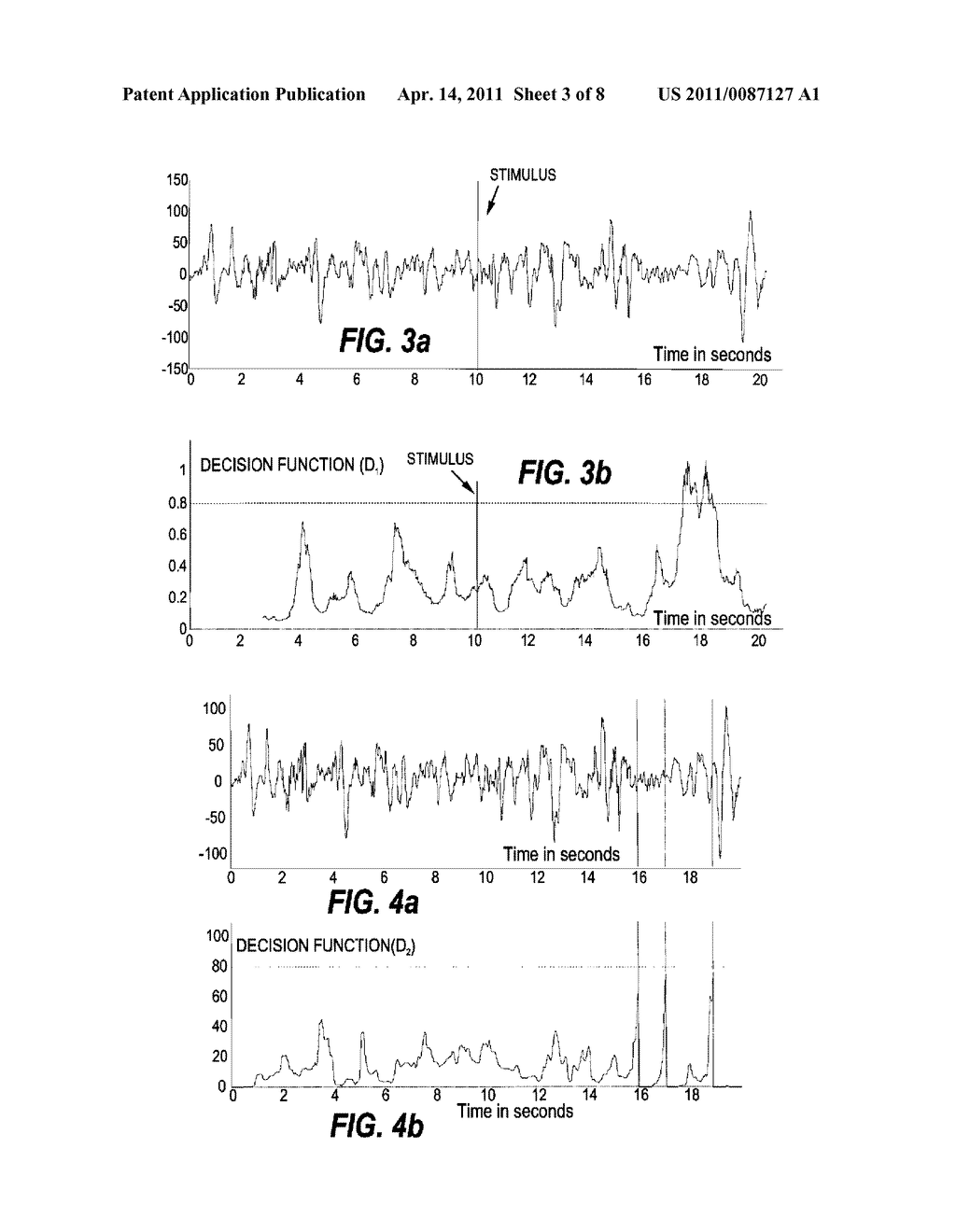 MEASUREMENT FOR EEG REACTIVITY - diagram, schematic, and image 04