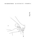 EXTENDABLE SPECIMEN COLLECTING DEVICE diagram and image