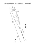 OCULAR IMPLANT WITH STIFFNESS QUALITIES, METHODS OF IMPLANTATION AND SYSTEM diagram and image